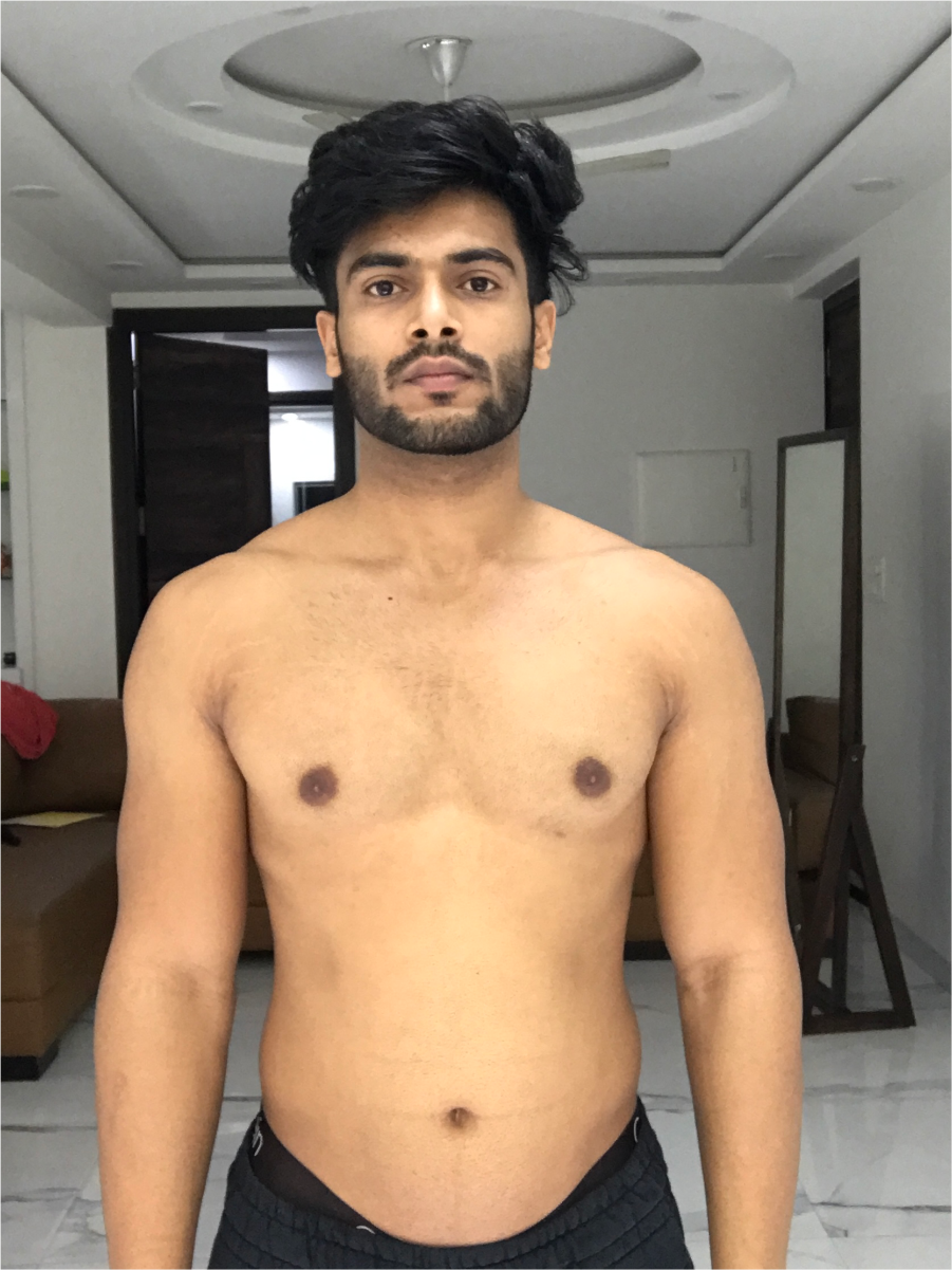 Gaurav before transformation